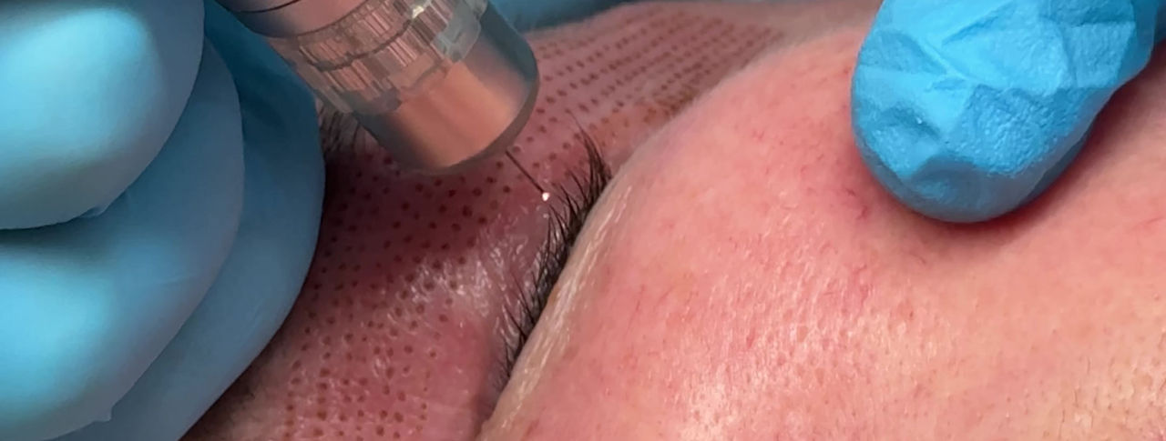 Phi-Ion Plasma lift
